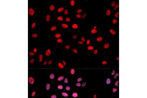 Immunofluorescence analysis of U2OS cells using Phospho-Jun(S243) Polyclonal Antibody (C-JUN antibody  (pSer243))