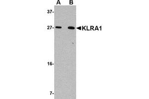 Western blot analysis of KLRA1 in 293 cell lysate with KLRA1 antibody at (A) 1 μg/ml and (B) 2 μg/ml.