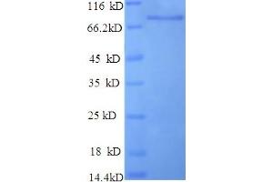 SDS-PAGE (SDS) image for NCAP (AA 1-168), (Extracellular) protein (GST tag) (ABIN5710994) (NCAP (AA 1-168), (Extracellular) protein (GST tag))