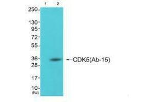Western blot analysis of extracts from cos-7 cells (Lane 2), using CDK5 (Ab-15) antiobdy. (CDK5 antibody  (Tyr15))