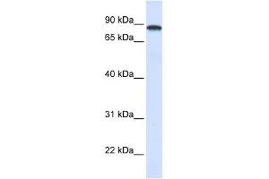 DDX1 antibody used at 1 ug/ml to detect target protein. (DDX1 antibody)