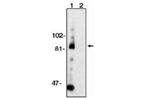 Image no. 1 for anti-ADAM Metallopeptidase Domain 10 (ADAM10) (AA 732-748) antibody (ABIN264988) (ADAM10 antibody  (AA 732-748))