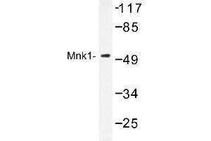 Image no. 1 for anti-MAP Kinase Interacting serine/threonine Kinase 1 (MKNK1) antibody (ABIN272252) (MKNK1 antibody)
