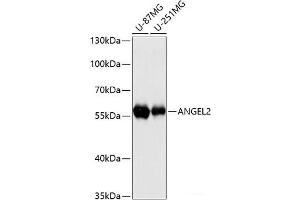 Western blot analysis of extracts of various cell lines using ANGEL2 Polyclonal Antibody at dilution of 1:3000. (ANGEL2 antibody)