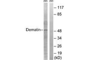 Western blot analysis of extracts from 293 cells, using Dematin (Ab-403) Antibody. (Dematin antibody  (AA 356-405))
