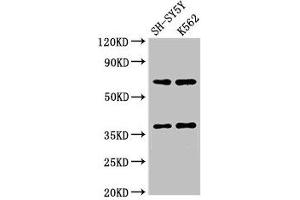 Western Blot Positive WB detected in: SH-SY5Y whole cell lysate, K562 whole cell lysate All lanes: CTSH antibody at 2. (Cathepsin H antibody  (AA 116-219))