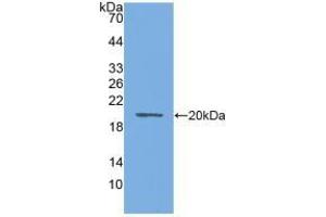 Detection of Recombinant AQP4, Mouse using Polyclonal Antibody to Aquaporin 4 (AQP4) (Aquaporin 4 antibody  (AA 177-304))