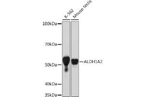 Western blot analysis of extracts of various cell lines, using  Rabbit mAb (ABIN7265532) at 1:1000 dilution. (ALDH1A2 antibody)