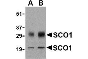 Western Blotting (WB) image for anti-SCO1 Cytochrome C Oxidase Assembly Protein (SCO1) (Middle Region) antibody (ABIN1031080) (SCO1 antibody  (Middle Region))
