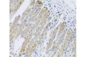 Immunohistochemistry of paraffin-embedded Mouse stomach using RARS2 Polyclonal Antibody at dilution of 1:100 (40x lens). (RARS2 antibody)