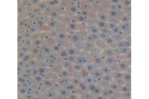 Used in DAB staining on fromalin fixed paraffin- embedded Kidney tissue (DDB2 antibody  (AA 212-407))