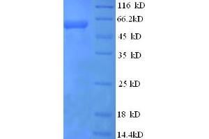 SDS-PAGE (SDS) image for Fatty Acid Binding Protein 9, Testis (FABP9) (AA 22-555) protein (His-SUMO Tag) (ABIN5710141) (FABP9 Protein (AA 22-555) (His-SUMO Tag))