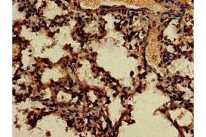 Immunohistochemistry of paraffin-embedded human lung tissue using ABIN7166683 at dilution of 1:100