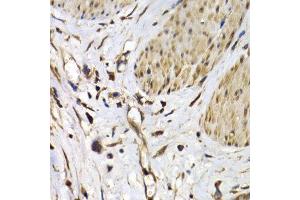 Immunohistochemistry (IHC) image for anti-ISG15 Ubiquitin-Like Modifier (ISG15) (AA 1-165) antibody (ABIN3021653) (ISG15 antibody  (AA 1-165))