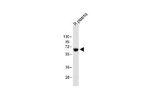 Anti-T Antibody (Center) at 1:2000 dilution + Rat plasma whole lysate Lysates/proteins at 20 μg per lane.