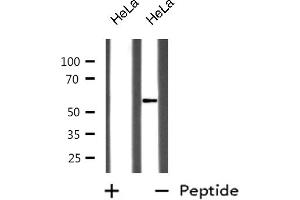 Western blot analysis of GABA-RB expression in HeLa whole cell lysates,The lane on the left is treated with the antigen-specific peptide.
