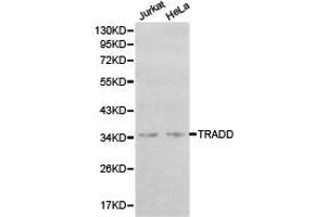 Western Blotting (WB) image for anti-TNFRSF1A-Associated Via Death Domain (TRADD) antibody (ABIN1875189) (TRADD antibody)