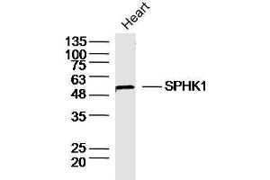 Mouse heart lysates probed with SPHK1 Polyclonal Antibody, unconjugated  at 1:30 overnight at 4°C followed by a conjugated secondary antibody at 1:10000 for 90 minutes at 37°C. (SPHK1 antibody  (AA 1-100))