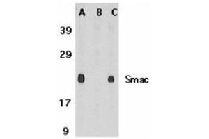 Western blot analysis of Smac in mouse heart tissue lysate in the absence (A) or presence (B) of blocking peptide and in rat heart tissue lysate with this product at 1 μg /ml. (DIABLO antibody  (C-Term))