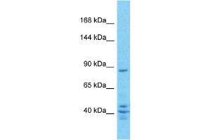 Host:  Rabbit  Target Name:  ZN160  Sample Type:  PANC1 Whole Cell lysates  Antibody Dilution:  1.