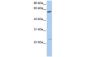 FAM3C antibody used at 1 ug/ml to detect target protein. (FAM3C antibody  (C-Term))