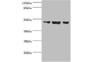 Western blot All lanes: Actin-like protein 6B antibody at 3 μg/mL Lane 1: Hela whole cell lysate Lane 2: U251 whole cell lysate Lane 3: HepG2 whole cell lysate Secondary Goat polyclonal to rabbit IgG at 1/10000 dilution Predicted band size: 47 kDa Observed band size: 47 kDa (Actin-Like 6B antibody  (AA 1-280))