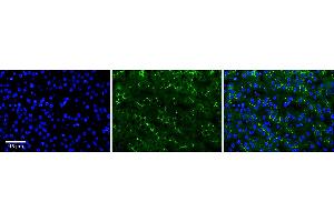 Rabbit Anti-ADCK2 Antibody  Catalog Number: ARP63131_P050 Formalin Fixed Paraffin Embedded Tissue: Human Adult Liver  Observed Staining: Membrane in bile canaliculi, strong signal, wide tissue distribution Primary Antibody Concentration: 1:100 Secondary Antibody: donkey anti-rabbit FITC Secondary Antibody Concentration: 1:200 Magnification: 20X Exposure Time: 0. (ADCK2 antibody  (Middle Region))