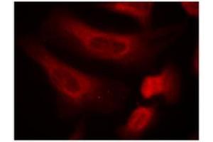 Image no. 3 for anti-Signal Transducer and Activator of Transcription 1, 91kDa (STAT1) (pSer727) antibody (ABIN196893)