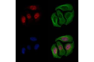 ABIN6254904 and ABIN6267568 staining Hela cells by IF/ICC.