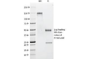 SDS-PAGE Analysis Purified CD53 Mouse Monoclonal Antibody (63-5A3).