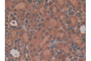 Immunohistochemistry (IHC) image for anti-Interleukin 22 Receptor, alpha 2 (IL22RA2) (AA 30-228) antibody (ABIN7435865)