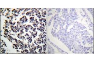 Immunohistochemistry analysis of paraffin-embedded human lymph node, using BLNK (Phospho-Tyr96) Antibody. (B-Cell Linker antibody  (pTyr96))