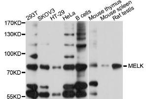 Western blot analysis of extracts of various cell lines, using MELK antibody (ABIN5998212) at 1/1000 dilution. (MELK antibody)