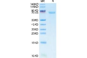 SDS-PAGE (SDS) image for CD276 (CD276) (AA 29-245) protein (FITC,Fc Tag) (ABIN7273960)