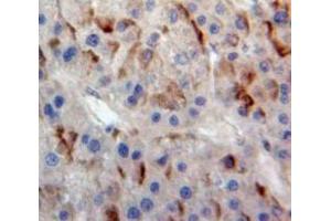 IHC-P analysis of Liver tissue, with DAB staining. (ABCB11 antibody  (AA 420-656))