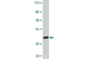 Western Blot detection against Immunogen (37. (PCTP antibody  (AA 106-214))
