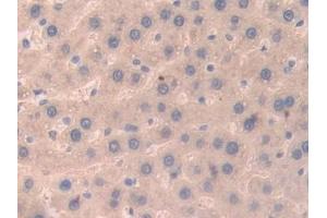 Detection of UBD in Rat Liver Tissue using Polyclonal Antibody to Ubiquitin D (UBD) (UBD antibody  (AA 1-155))