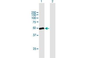 Western Blot analysis of GC expression in transfected 293T cell line by GC MaxPab polyclonal antibody. (Vitamin D-Binding Protein antibody  (AA 1-474))