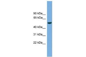 WB Suggested Anti-TMPRSS4 Antibody Titration:  0. (TMPRSS4 antibody  (N-Term))