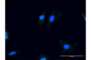 Immunofluorescence of purified MaxPab antibody to ITGAV on HeLa cell.