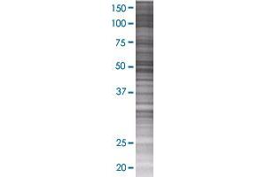GAL3ST1 transfected lysate. (GAL3ST1 293T Cell Transient Overexpression Lysate(Denatured))