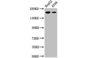 Western Blot Positive WB detected in: HepG2 whole cell lysate, A549 whole cell lysate All lanes: LRRK1 antibody at 3 μg/mL Secondary Goat polyclonal to rabbit IgG at 1/50000 dilution Predicted band size: 226, 29 kDa Observed band size: 226 kDa (LRRK1 antibody  (AA 1-68))
