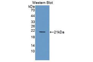 Western blot analysis of recombinant Human PDGFBB.