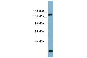EPRS antibody used at 1 ug/ml to detect target protein. (EPRS antibody  (Middle Region))