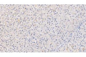 Detection of CRAT in Human Liver Tissue using Polyclonal Antibody to Carnitine Acetyltransferase (CRAT) (CRAT antibody  (AA 363-626))