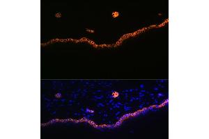 Immunofluorescence analysis of rat skin using Cytokeratin 15 (KRT15) (KRT15) Rabbit mAb (ABIN7268093) at dilution of 1:100 (40x lens). (KRT15 antibody)