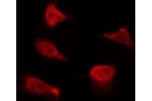 ABIN6267385 staining 293 by IF/ICC. (Ezrin antibody  (pTyr478))