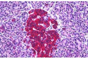 Human Pancreas, Islets of Langerhans: Formalin-Fixed, Paraffin-Embedded (FFPE) (Glutamic Acid Decarboxylase antibody  (AA 545-594))