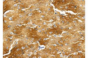 ABIN6265356 and ABIN6277579 at 1/100 staining Rat brain tissue by IHC-P. (STXBP1 antibody  (C-Term))