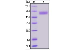 SDS-PAGE (SDS) image for B and T Lymphocyte Associated (BTLA) (AA 31-150) protein (Fc Tag,AVI tag,Biotin) (ABIN5954952)